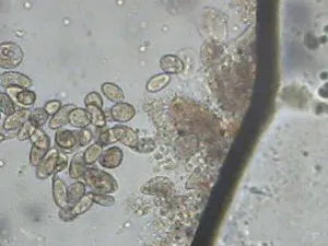 Chilodonellosis